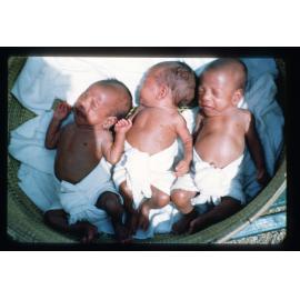 Papuan triplets