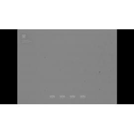 Council worker unionist attend a strike meeting